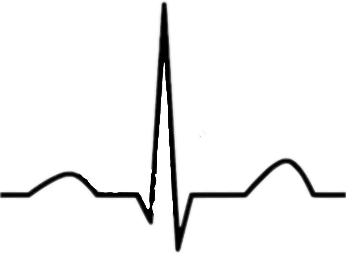 Экг рисунок. Удлинение QRS. Электрокардиограмма рисунок. ЭКГ картинки.