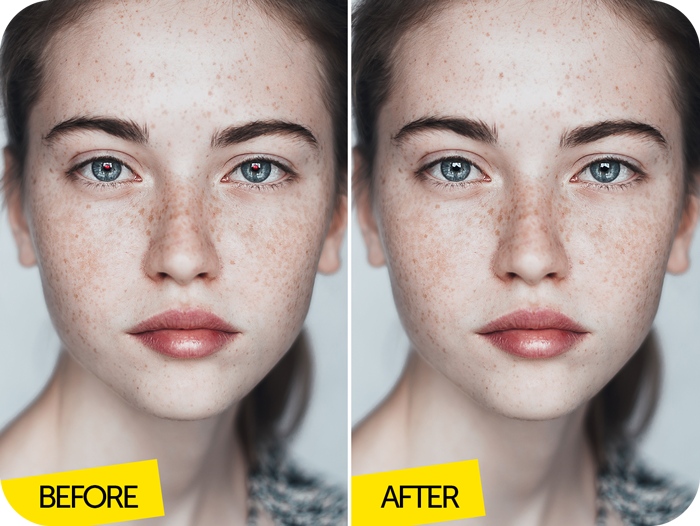 freckles girl before after Image